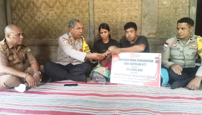Bocah Penderita Hydrosephalus  Asal Desa Bamo, Terima Bantuan Kapolda NTT