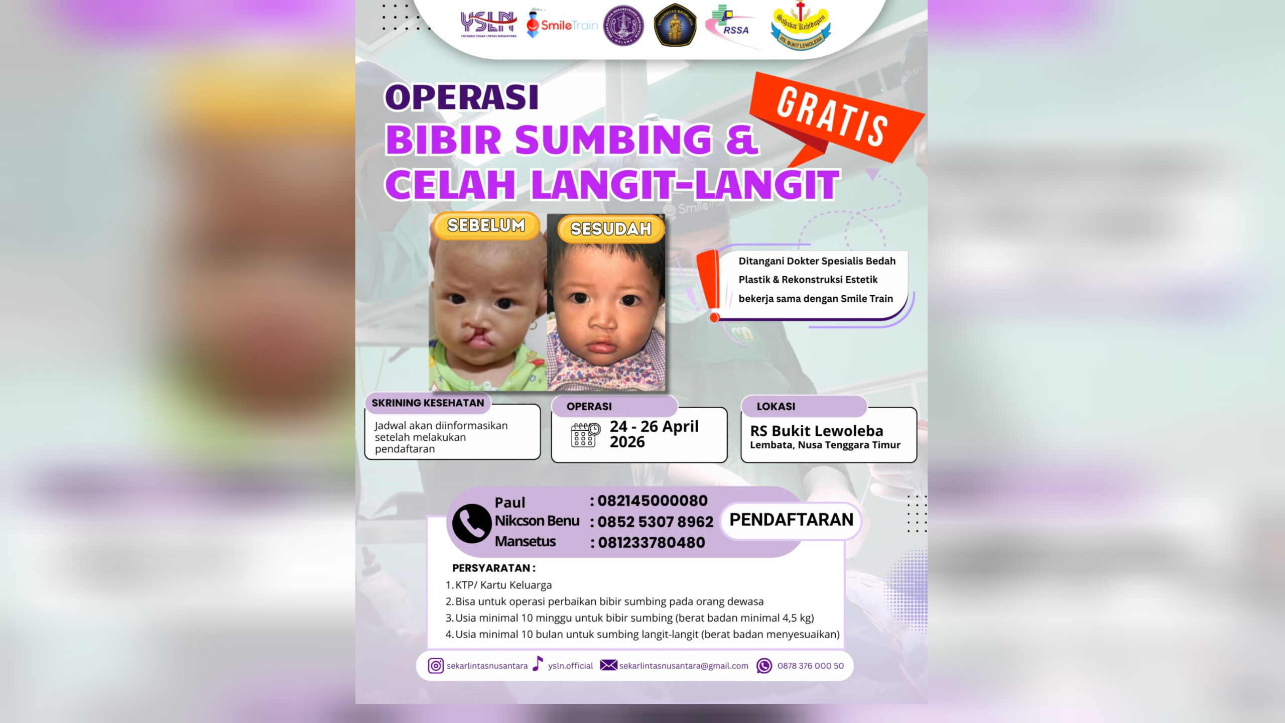 Buruan Daftar, April 2026 Ada Baksos Operasi Bibir Sumbing dan Katarak Gratis di Lembata